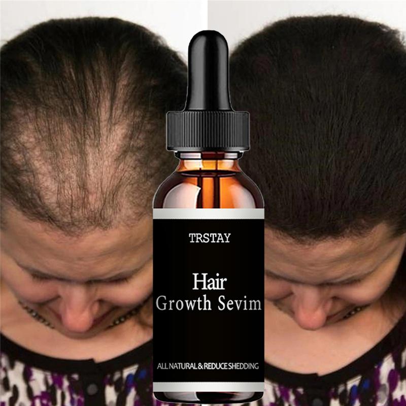 5ML/15ML/30ML/50ML/Moroccan Oil Hair Essential Oil, Care For Split Dry And Knotted Damaged Hair, Makes Hair Soft And Shiny