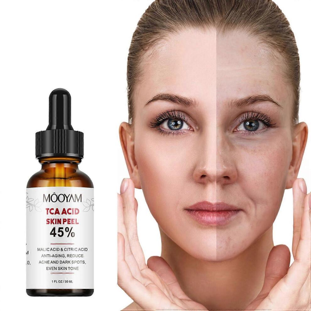 45% Citric Acid Skin-Renewing Serum  Anti-Ageing, Brightening, Spot-Reducing, AHA Peel Treatment Serum