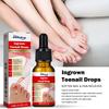 Zehennagelpflege-Serum 10ml Feuchtigkeitsspendendes Nagelöl Fußpflegebehandlung Nährende Nagelpflege-Essenz für den täglichen Gebrauch