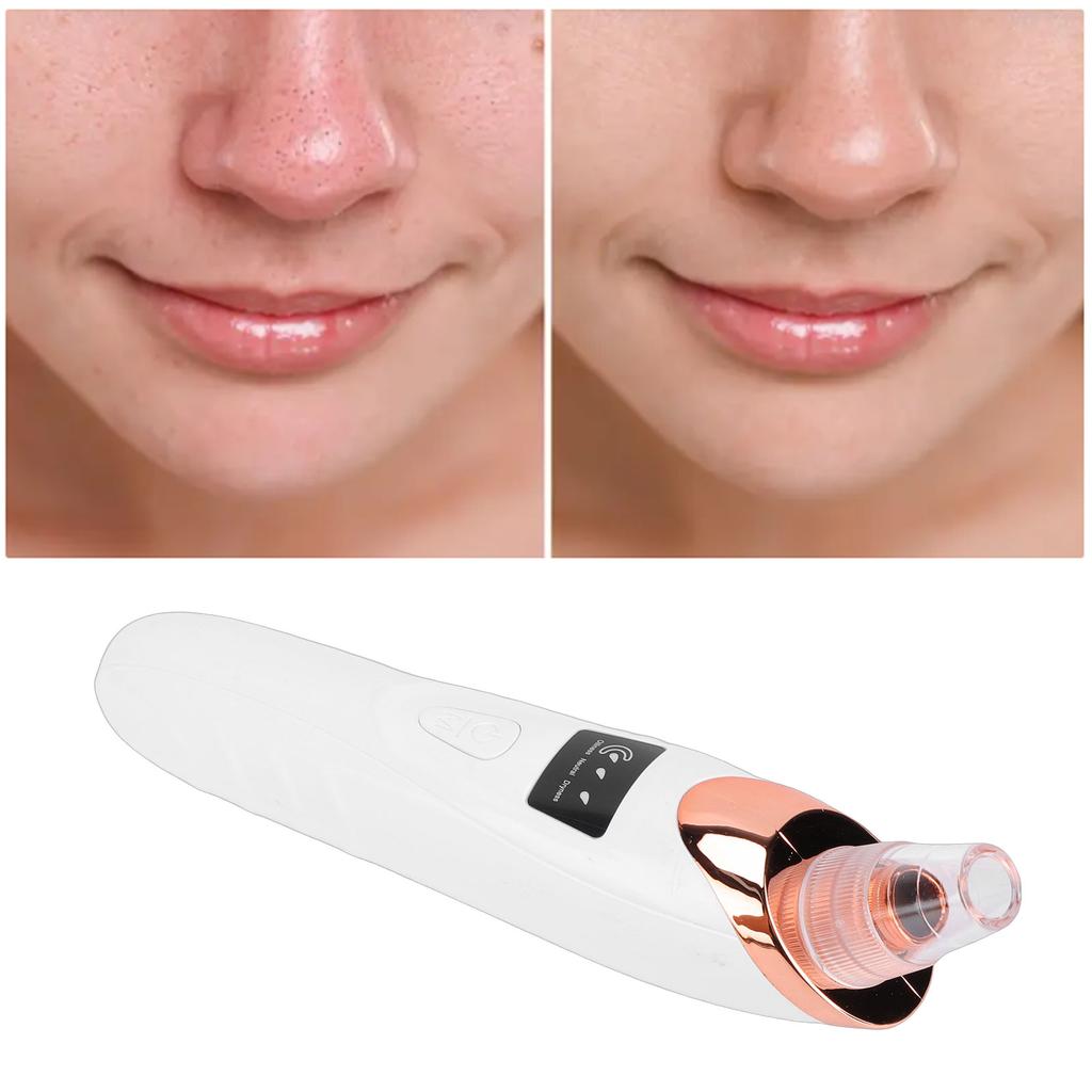 Pore Vacuum Blackhead Remover Whitehead Removal Pimple Extractor Pore Vacuum with LED Indicators 4 Nozzles 4 Pcs Needle