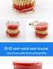 Dental Educational and Communication Model Set: Comprehensive, Removable, and Implant Restoration Models