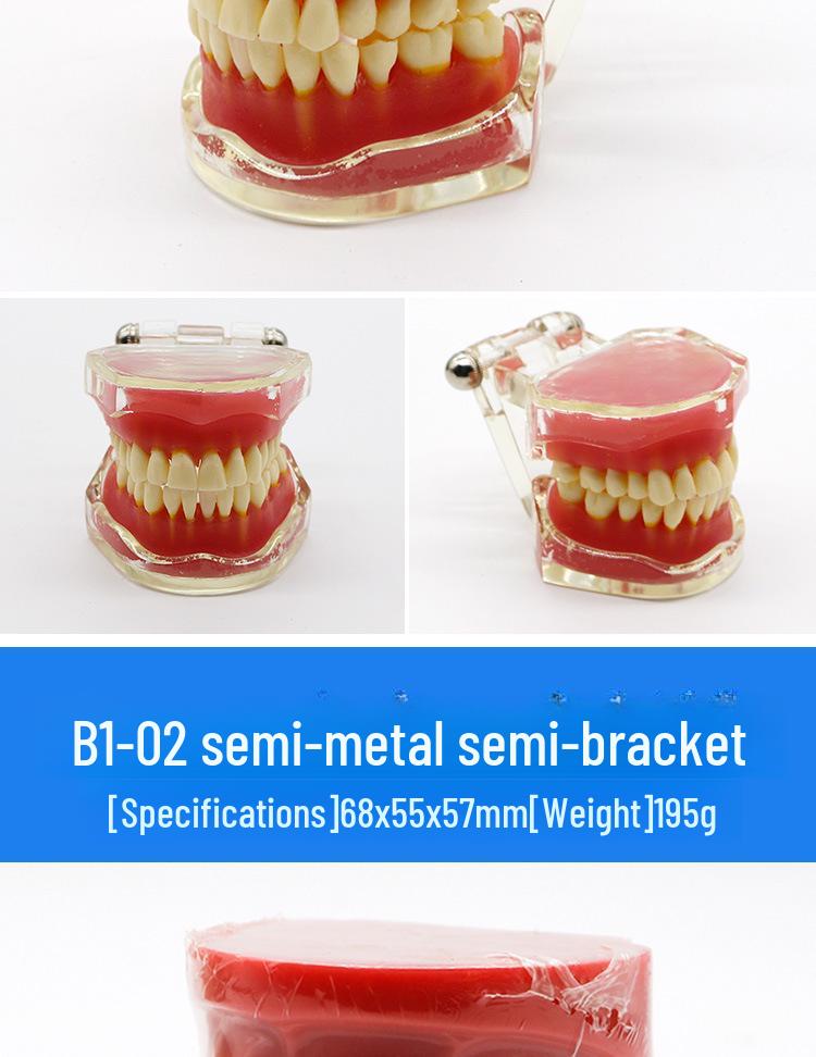 Dental Educational and Communication Model Set: Comprehensive, Removable, and Implant Restoration Models