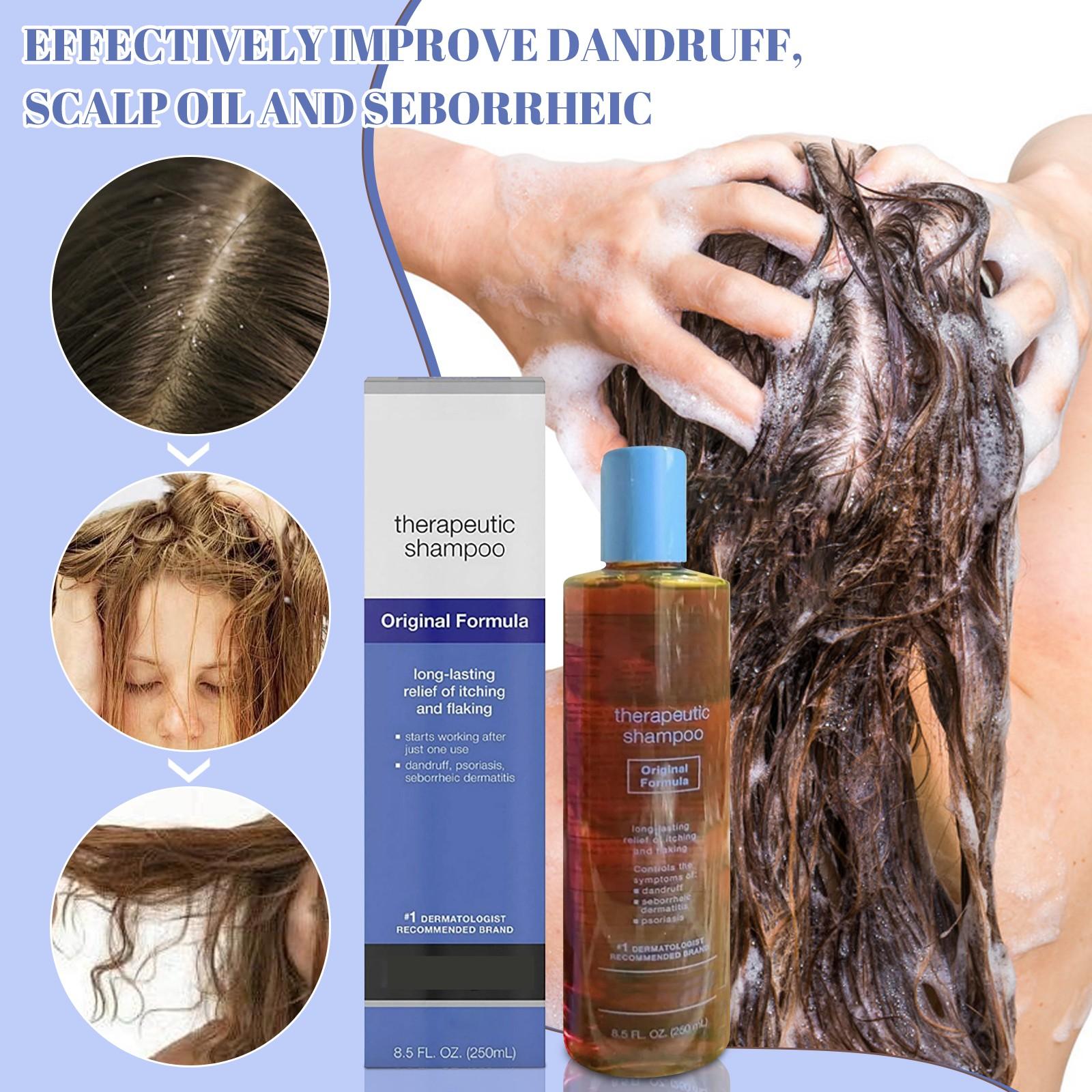 

Лечебный шампунь - Уход за кожей головы , Перхоть , Себорейный дерматит , Зуд кожи головы , Перхоть 250мл One Size