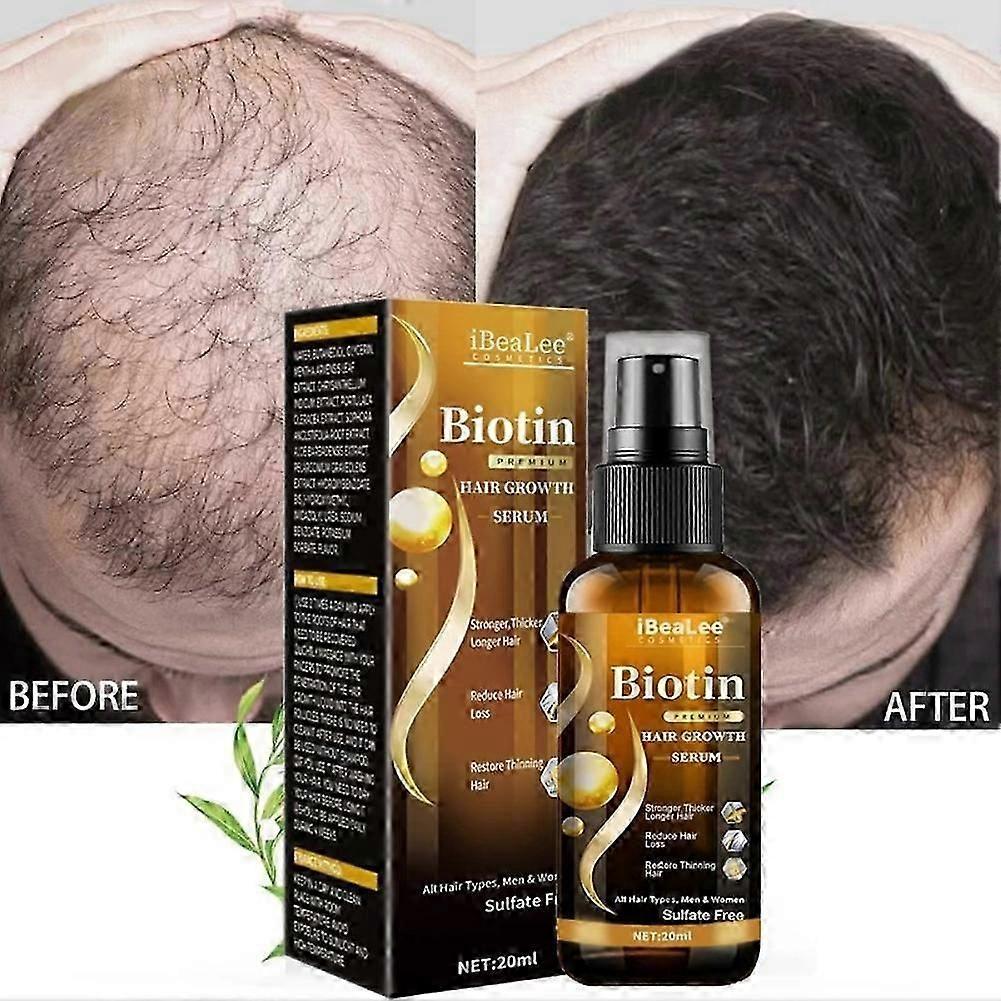 Biotin Hair Growth Spray Anti Hair Loss Fast Regeneration Scalp Treatment Essence