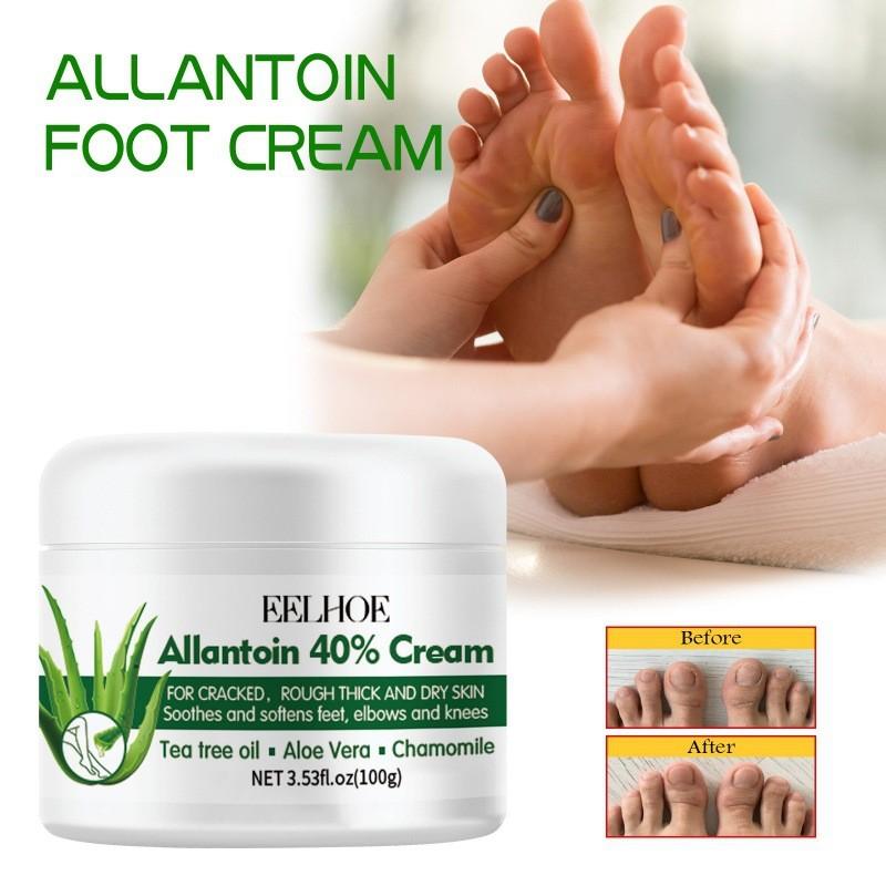 Eelhoe Nourishing Foot Care Cream For Dry Cracked Skin Moisturizing And Hydrating 100g