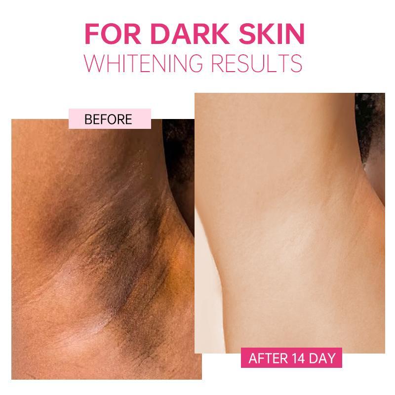 AUQUEST Hudblekekrem Underarm Armhule Kne Mørk Flekk Krem for Private Deler Hudpleie Fjerne Melanin Skjønnhet Helse 50ml
