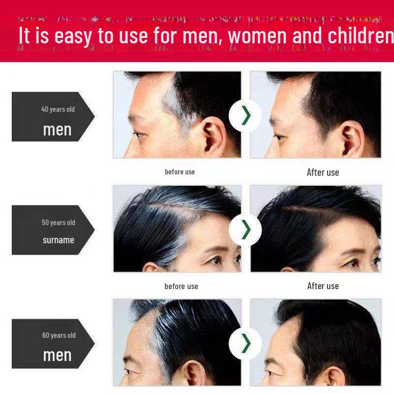 Serinfanner Temporärer Haarfärbestift - Braun/Schwarz, sofortige Abdeckung für graue Haarwurzeln