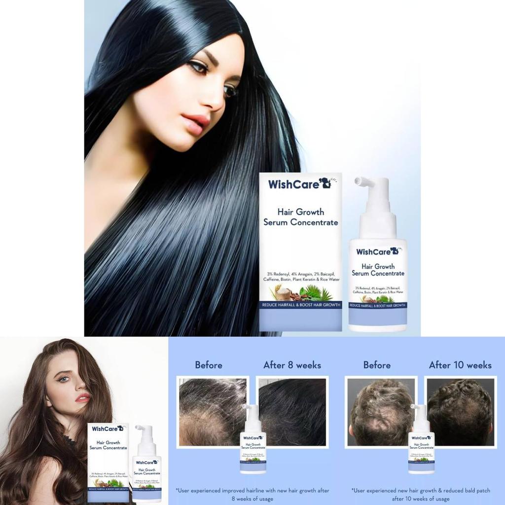 B3014 Hair Growth Concentrate Serum For Home Use With Luxurious Packaging For All Hair Types