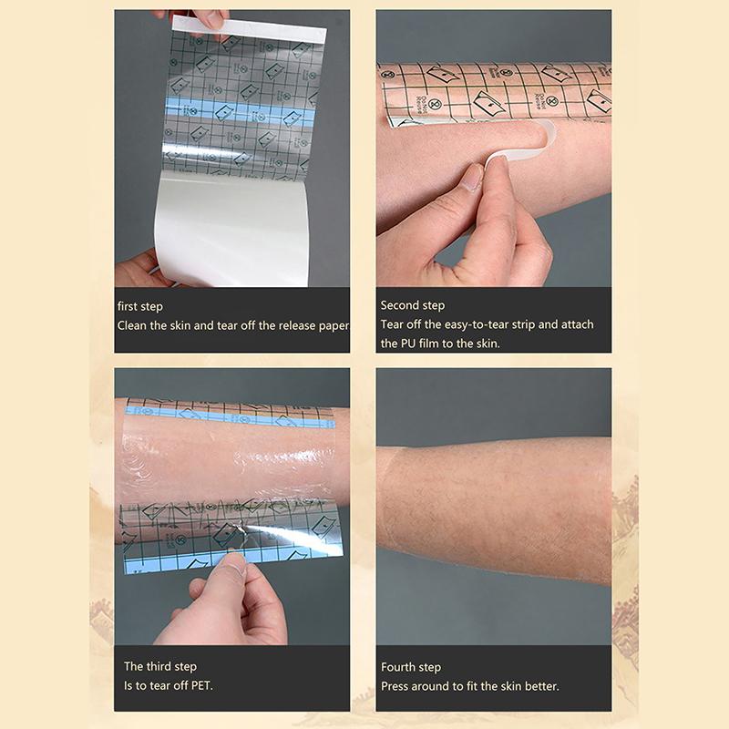 100Pcs Medical Adhesive Waterproof Tape Transparent Tape Pu Anti-Allergic Medicinal Wound Dressing Fixation Tape