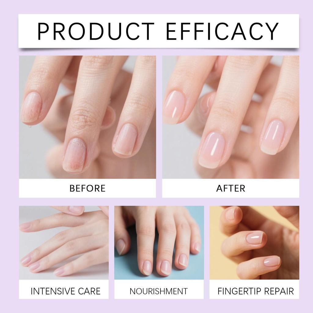 Nail Essence Care Pen For Hangnails Dry&Damaged Nails Nourishing Moisturizing Strengthen Brighten Nails Care Cuticle Oil Pen