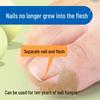 Glue-Free Natural Ingrown Toenail Corrector Stickers