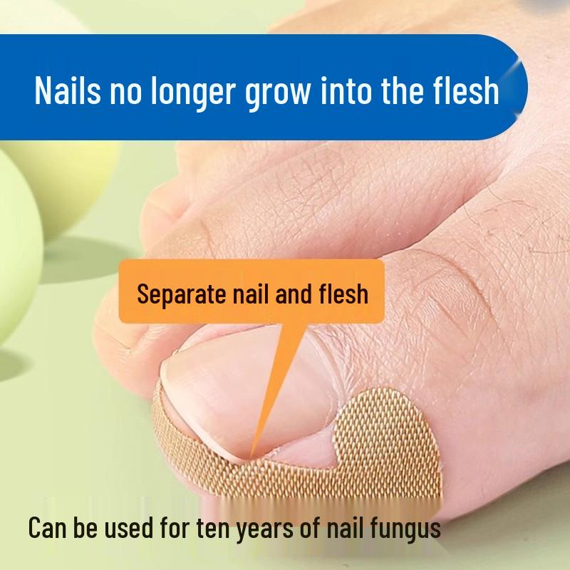 Glue-Free Natural Ingrown Toenail Corrector Stickers