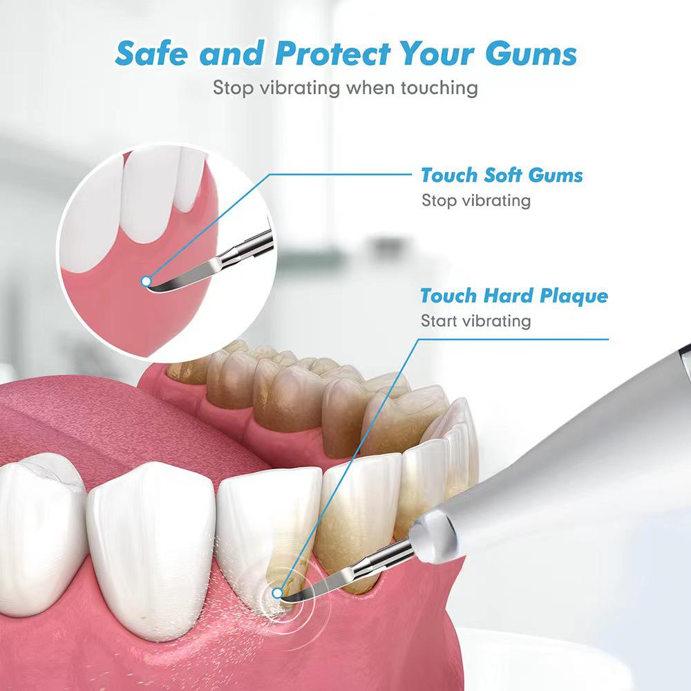 Portable Ultrasonic Tooth Cleaner - Tartar Removal & Whitening Device