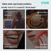 Haoyikang 520 Lysozyme Toothpaste Set