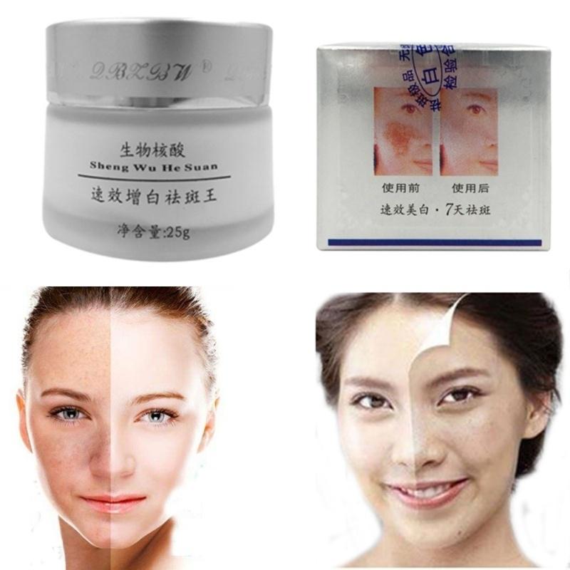 Women Strong Effects Powerful Whitening Freckle Cream Remove Melasma