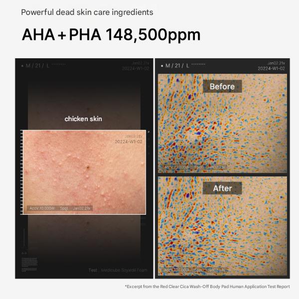 Medicube Red Clear Cica Wash-Off Body Pad 50 Pads (200ml) (3 Options)