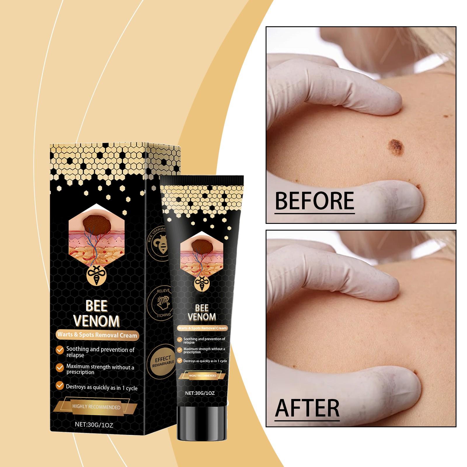 

Крем против морщин Увлажняющий крем Крем против невусов Крем для гладкой кожи Мягкий травяной крем