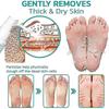 1-3PCS Professional Callus Remover Extra Strength Spray, Foot Callus Removal Spray, Instant Foot Peeling Spray Warding Off Foot