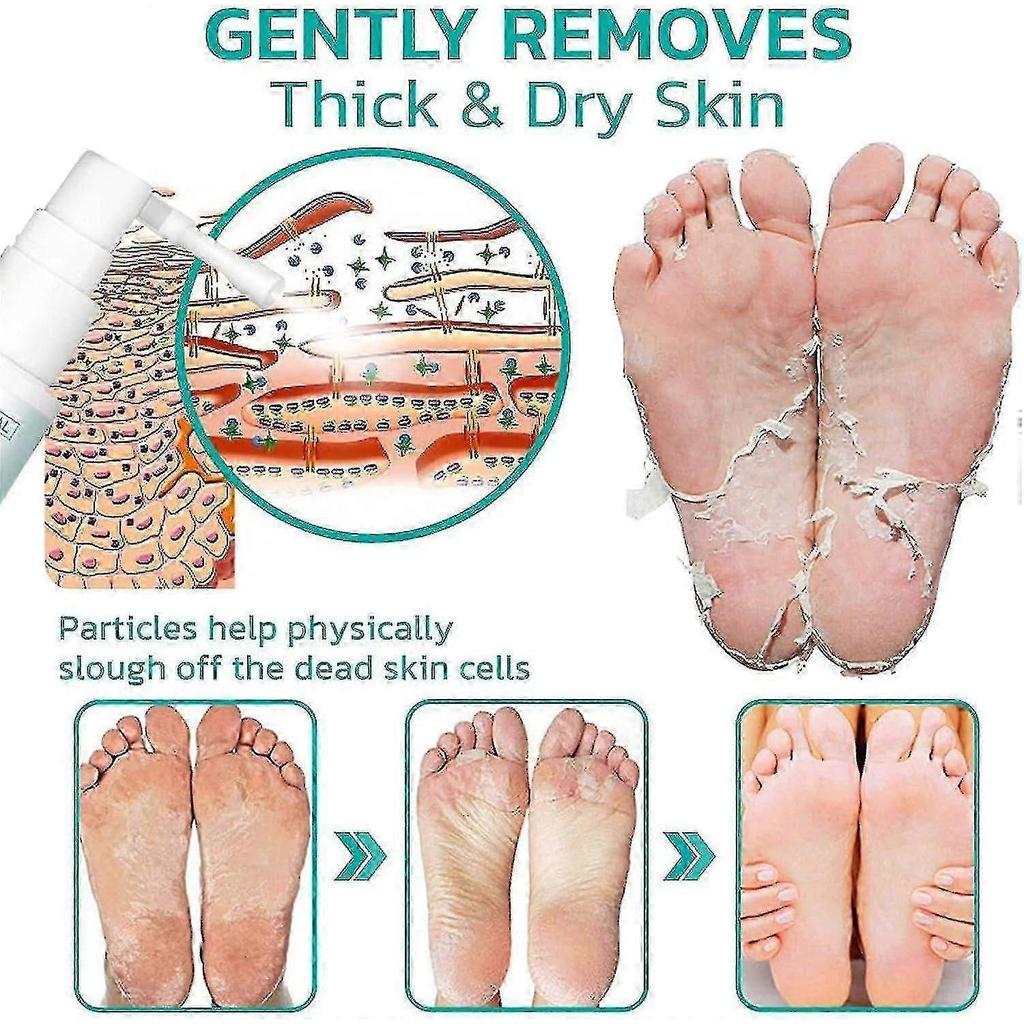 1-3PCS Professional Callus Remover Extra Strength Spray, Foot Callus Removal Spray, Instant Foot Peeling Spray Warding Off Foot