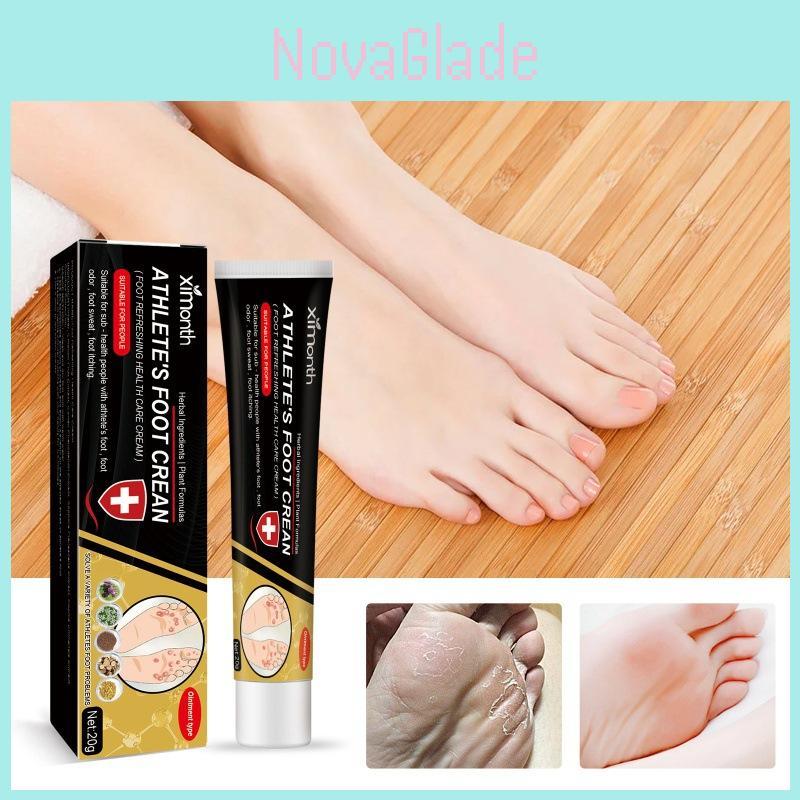Ximonth Foot Odor Removal Cream With Soothing Formula For Itchy And Dry Skin Care