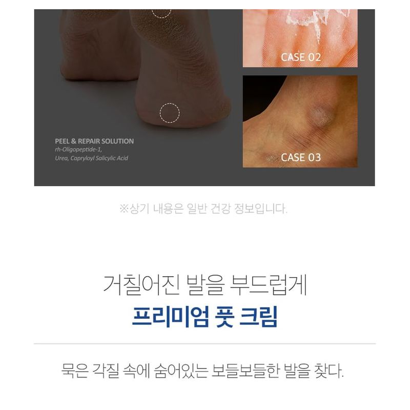MEDIPEEL - EGF Scaling Moisture Foot Cream