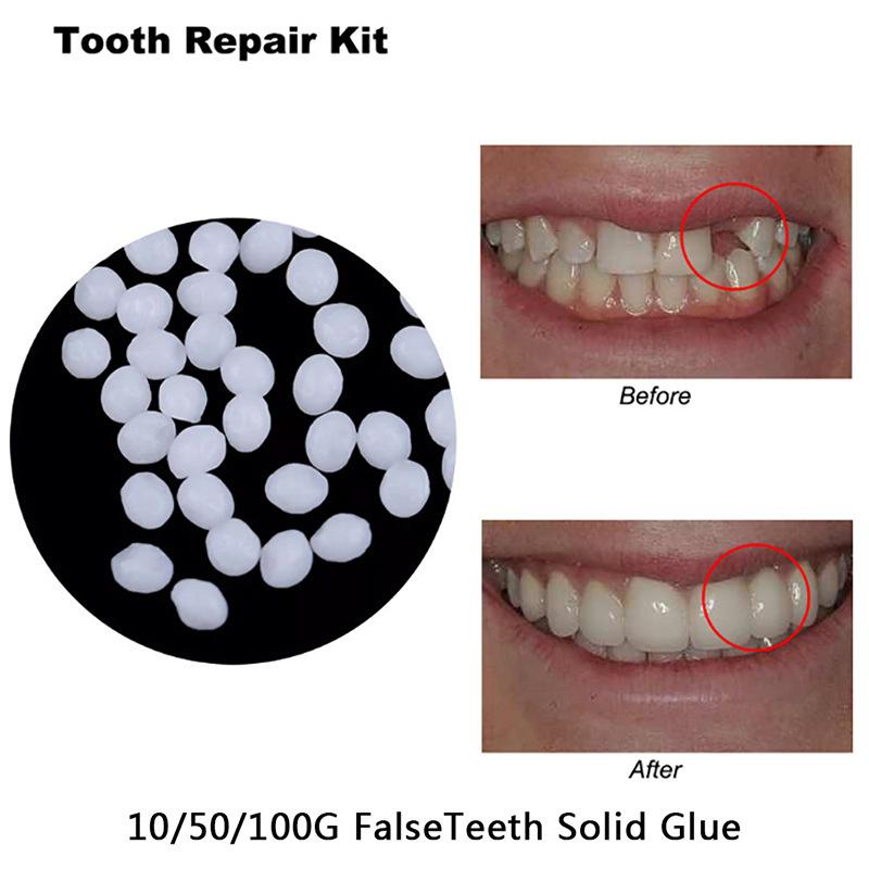 5/10/20/50/100g Resina Dentale Modellabile Colla per Denti Riempimento Temporaneo Riparazione Denti Trucco Materiale Dentale Particelle