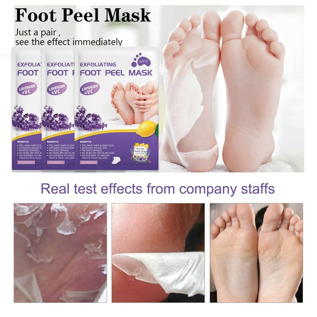 Callosités Pieds Peeling Pieds Callosités Pieds Pieds Exfoliant Élimine Peaux Mortes Pieds Plus Lisses et Plus 3 Paires Paquet, Paquet, Soin, Masque, Masque, Peau,