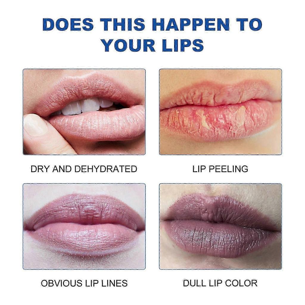 West Month Moisturizing Lip Balm, Moisturizing Lip Care Whitening Lip Lines Broken Black Lip Moisturizing Lip Balm