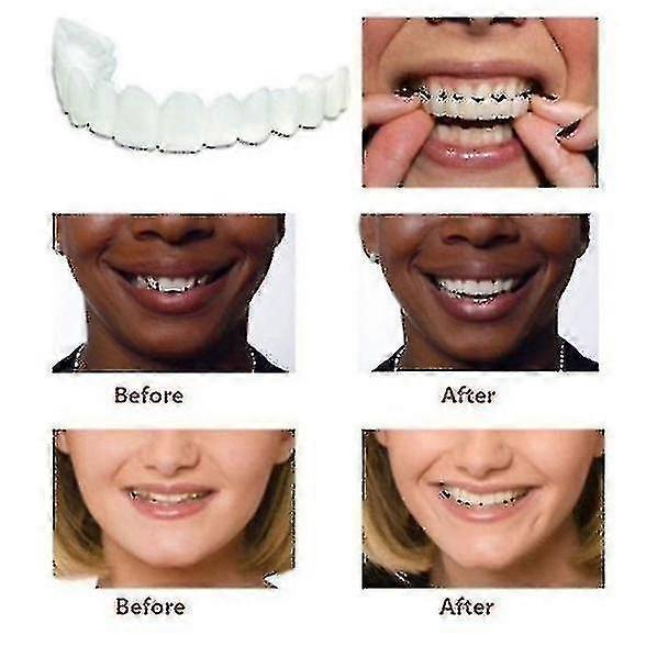 A Pair Upper & Lower High Quality Denture Instant Smile Comfort Fit Flex Cosmetic Teeth Denture Teeth Top Cosmetic Veneer High Quality Prime Day