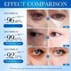 1/2PCS Collagen Eye Cream Stick, Eye Cream, Moisturizing, Repairing Skin, Reducing Dryness And Fine