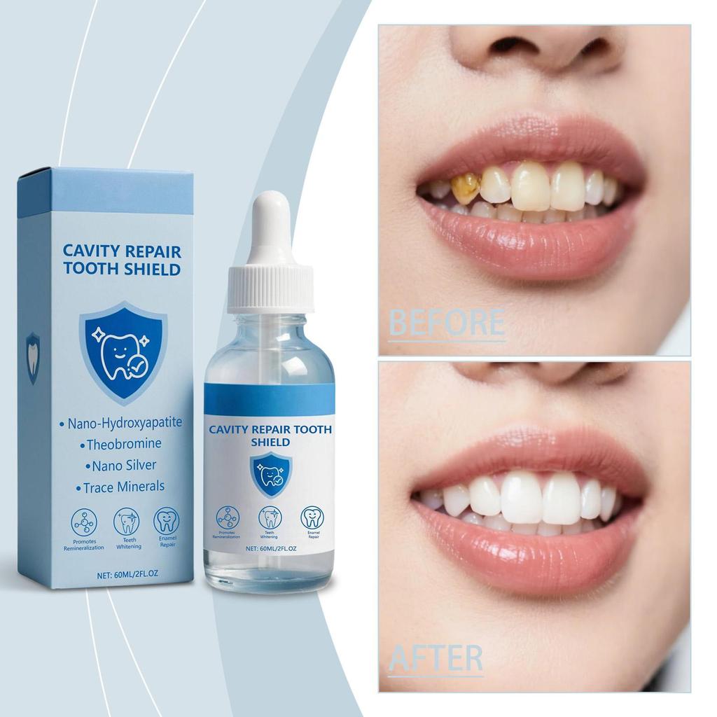 Decay Tooth Repair Liquid Remove Dental Plaque Tartar Relieve Sore Deep Cleaning Whitening Teeth Cavities Protect Serum Essence