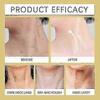 AH-8 Firming Neck Cream + Electric Massage Eye Cream, Neck-Eye Care Tightening & Revitalizing Set, Eye & Neck Treatment, Smooth of Fine Lines 25-26