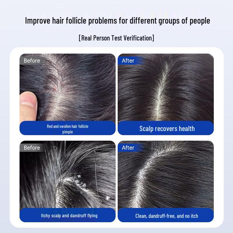 Kaishidiman Hair & Scalp Care Shampoo