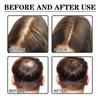 Hair Growth Serum, Jaysuing: Prevents Hair Loss, Nourishes Dry and Damaged Hair, Promotes Natural Hair Growth, and Prevents Hair Loss