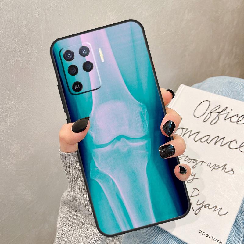 X-Ray Human Anatomy Case For Oppo A40 A60 A80 A78 A38 A18 A98 A58 A96 A76 A16 A94 A74 A54 A15 A17 A57 A77 A5 Pro