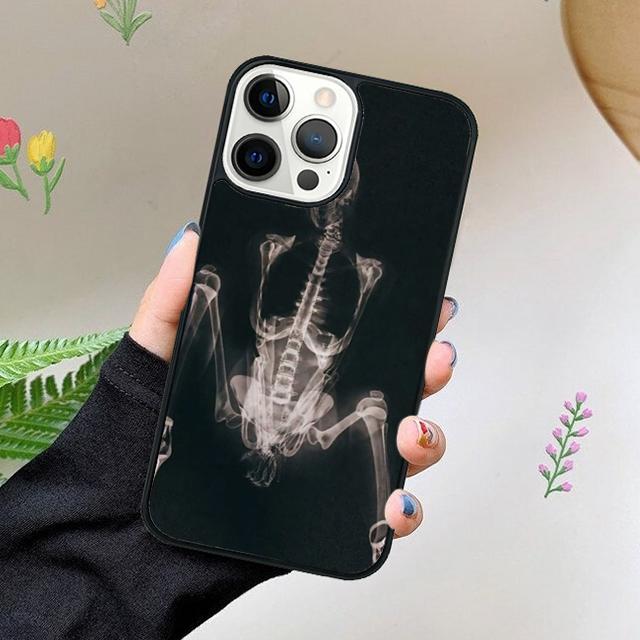 Röntgenaufnahme Menschliche Anatomie Handyhülle Für iPhone 17 Air 15 16 16e 11 12 13 14 Pro Max Hülle Für iPhone 17 Air Max Plus coque Fundas