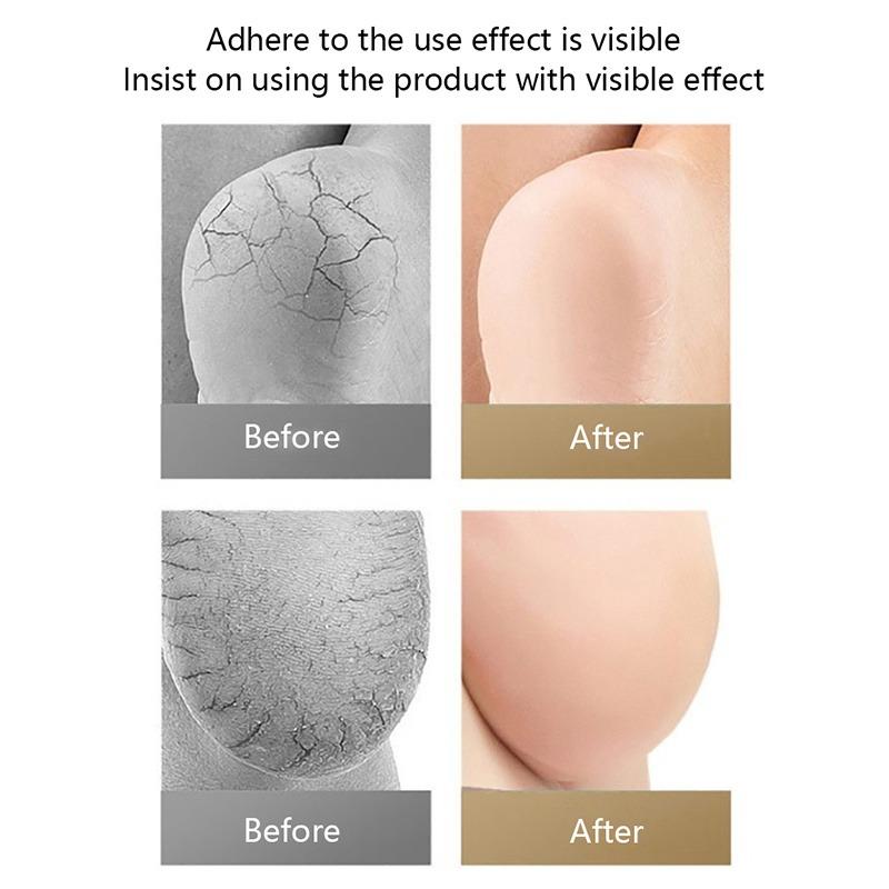 2PCS Gel Silicone Heel Protector Sleeve Repair Cushion Half-yard Socks Heel Pads Heel Cups Plantar Fasciitis Support Feet Care