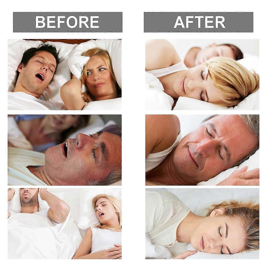 Anti-Snoring Mouth Guard, Advanced Snore Solution Mouthpiece, Stop Snoring Devices Night Guard for Clenching & Gnashing