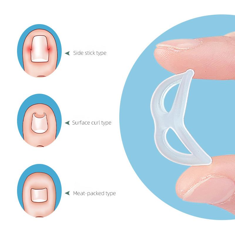 Herramienta de Silicona para Corrección de Uña Encarnada – Protector Enderezador Invisible y Soporte para Pedicura y Cuidado de los Pies