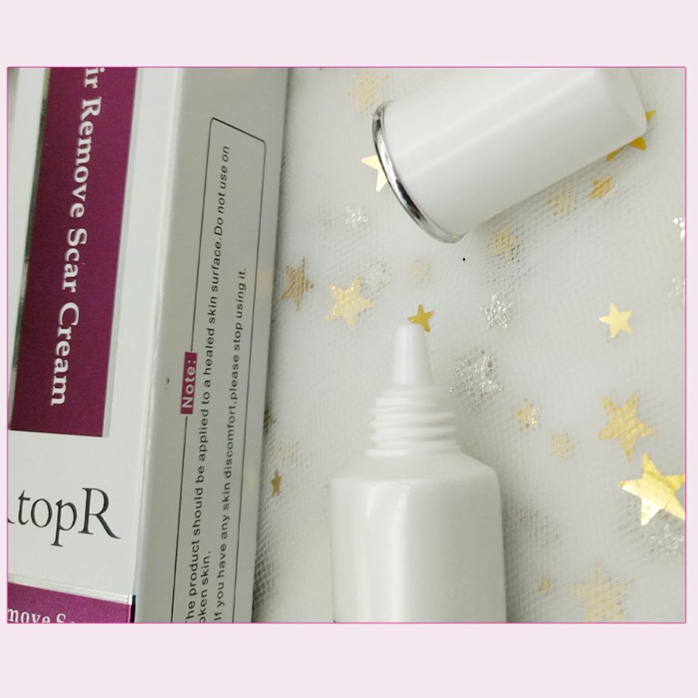 Acne Remover Cream Skin Repair Face Cream Acne Spots Acne Treatment Blackhead Whitening Cream Skin Care