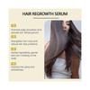 Hoegoa Hair Essence Spray Hair Soft Glossy Ginger Hair Care Scalp Care Spray