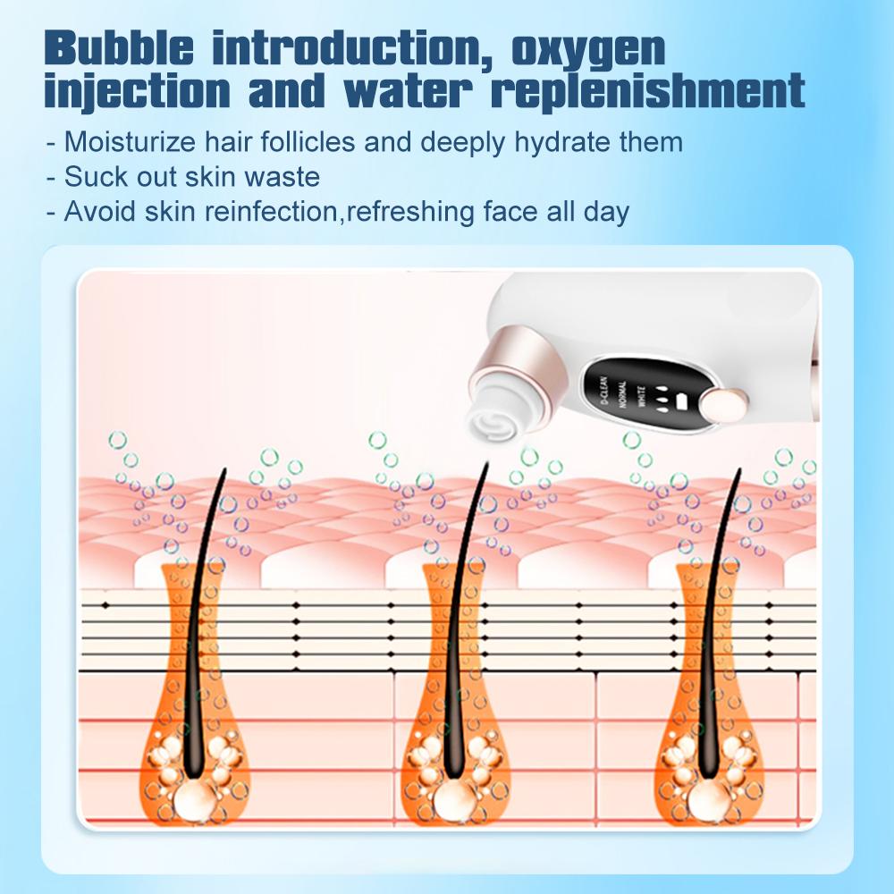 Electric Bubble Blackhead Remover Pimple Black Head Spot Acne Removal Vacuum Suction Pore Cleaner Facial Cleaning