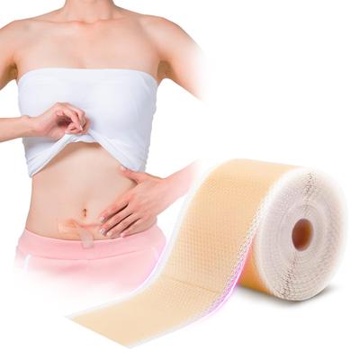 CMD Yara Bakım Bandı, Keloid Bandı, 4cm x 150cm, Sezaryen Yara Bakımı, Yara Gizleme, Silikon Jel Tabaka, Cilt Rengi (1 Rulo)