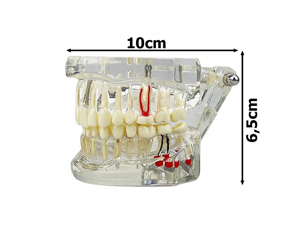 Dental Model 2 White (100) Gab_B