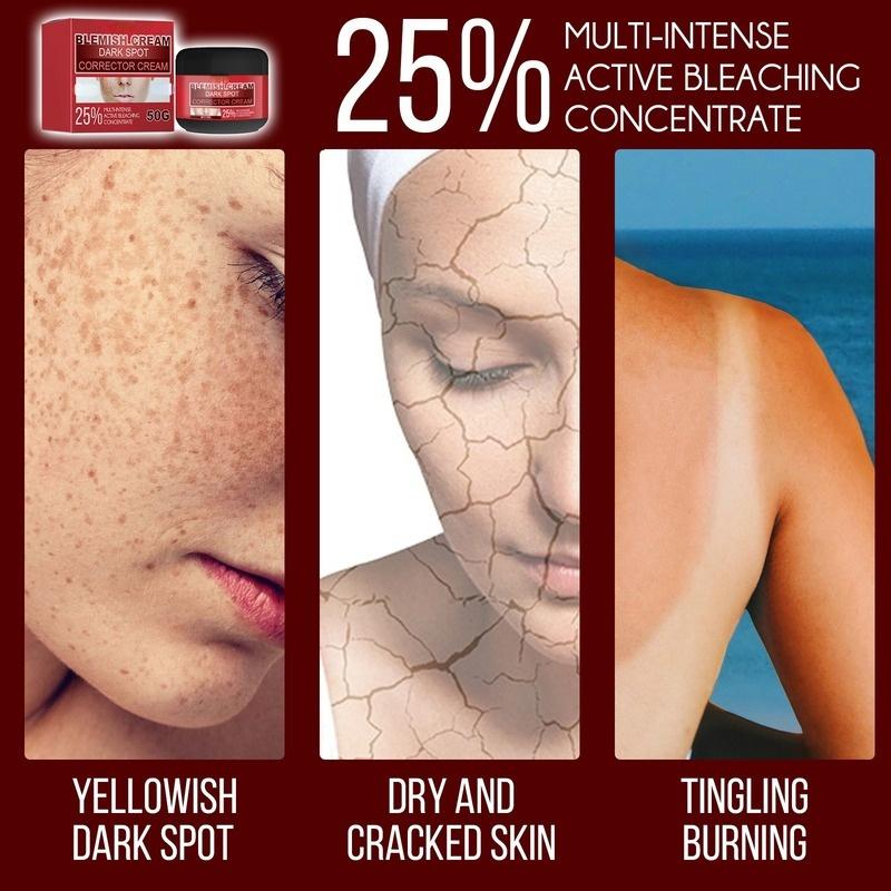 Whitening and Brightening Blemish Cream, Purifying, Brightening and Diminishing Spots, Universal for Men and Women