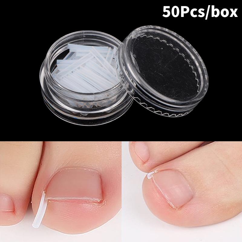 50Pcs Ingrown Toenail Correction Tool Ingrown Toe Nail Treatment Elastic Patch Sticker Straightening Clip Brace Pedicure Tool