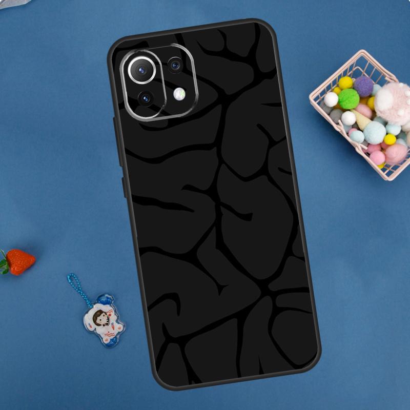 Anatomy Brain Case For Xiaomi 14 13 15 Ultra 11T 12T 13T 14T Pro POCO X7 Pro X3 X5 F5 F6 M6 X6 Pro Cover