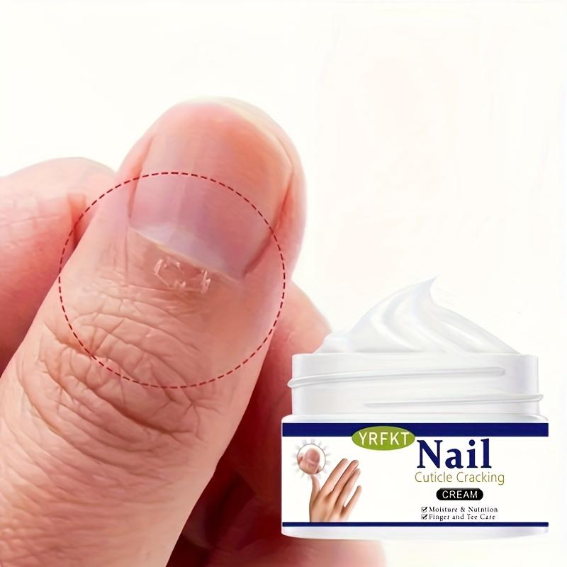 Natural nail care cream, gentle and moisturizing, used for nail care to prevent dryness. Physical exfoliation