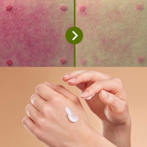 ZEROID Intensive SOS+ Balm 40ml