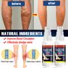 Vein Varicose Veins Spray, Vein Varicose Veins Spray, Vein Varicose Veins Spray 30ml